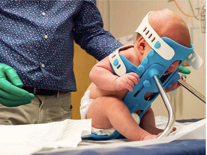 Revolutionizing Infant Lumbar Punctures with the SMöLTAP Device A Game
